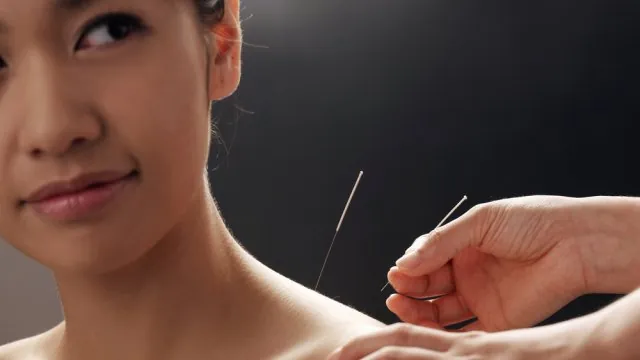 Pose d'aiguilles d'acupuncture sur l'épaule d'une patiente